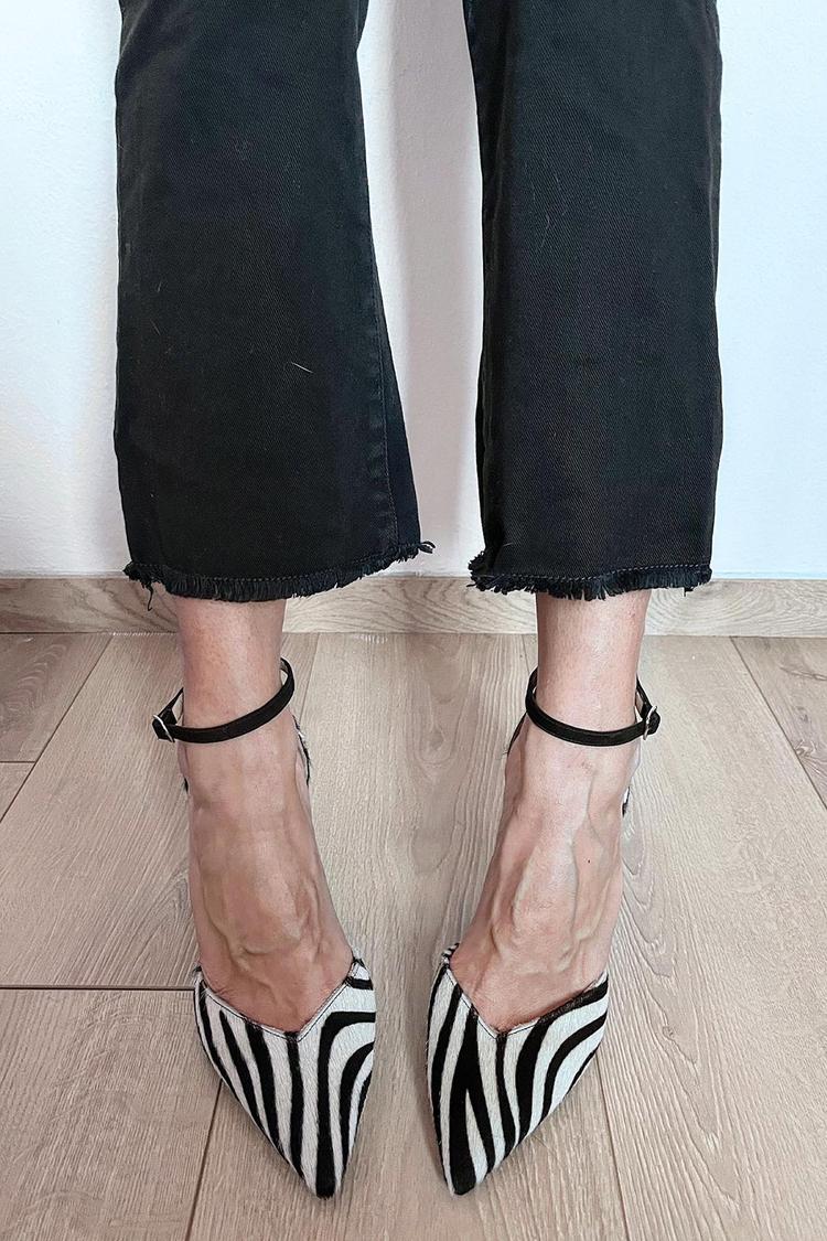 Calyra | Zebra Pumps